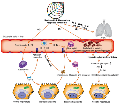 
Cơ chế phân tử cơ bản của bệnh do coronavirus-tổn thương gan liên quan đến 19 gây ra bởi hội chứng phản ứng viêm hệ thống và thiếu máu cục bộ thiếu oxy.
