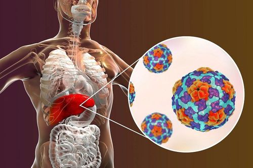 Update on clinical features of liver injury in patients with covid-19