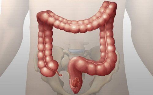 Can I have surgery if I have a bowel obstruction when I have diabetes complications?