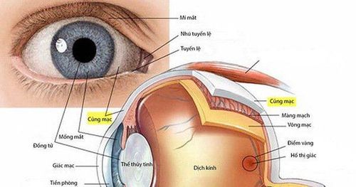 
Vị trí của củng mạc được xác định trước khi phẫu thuật cắt củng mạc sâu
