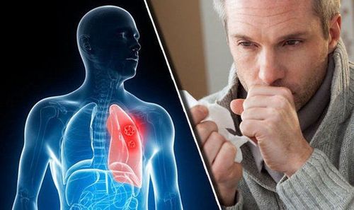 Các triệu chứng của ung thư phổi như ho kéo dài, ho ra máu, khó thở, suy nhược,...