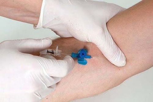 Insertion of the needle does not cause much pain