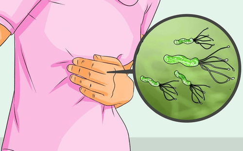 Symptoms outside the stomach when infected with Helicobacter pylori