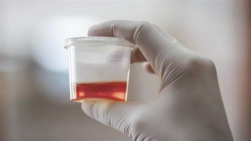 Hematuria in adults