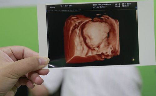 Tư vấn kết quả siêu âm Doppler thai 33 tuần tuổi?