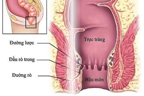 Phẫu thuật đường rò hậu môn cho trẻ có nguy hiểm không?