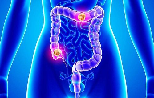 Treatment of mixed epithelial tumors of the colon and rectum