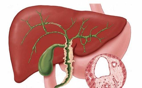 Role of bile acids in gut microbiota-mediated cholestatic liver disease