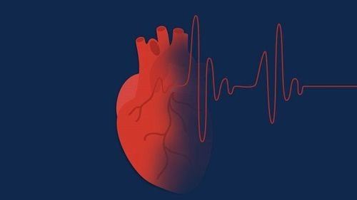 Does tachycardia need an MRI of the head?