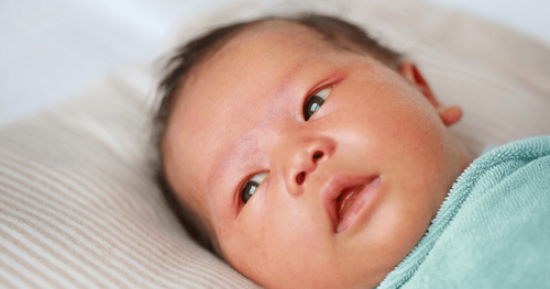 Prolonged jaundice in newborns, what to do?