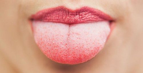 Numbness on the tip of the tongue loses taste often warns of symptoms of a dangerous disease