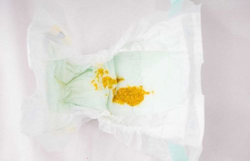 Phân của trẻ sơ sinh có một số đặc điểm riêng biệt