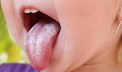 Taste map on the human tongue