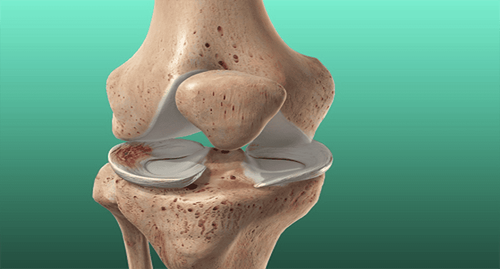 Rehabilitation in men with torn meniscus of the knee joint