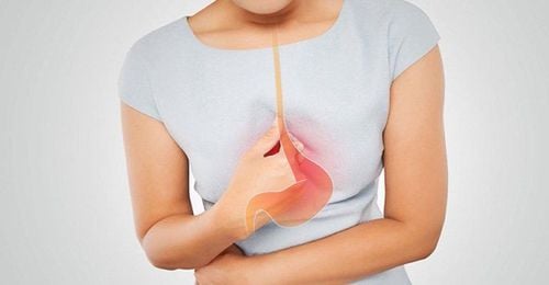 Yellow gastric juice is reflux bile?