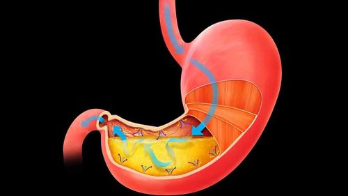 Digestive system characteristics and nutritional needs of children