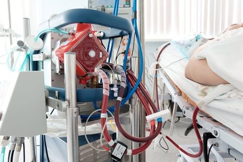 Nữ giới dịch tràn màng phổi, chạy ECMO có ảnh hưởng gì?