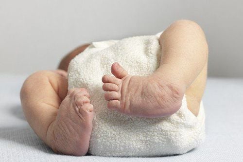 Achondroplasia - Loạn sản sụn: Những điều cần biết