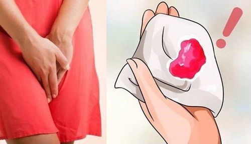 Chảy máu kéo dài sau sinh mổ có bất thường không?