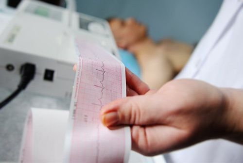 Điện tâm đồ có thể giúp bác sĩ chẩn đoán tình trạng tụt huyết áp sau ăn