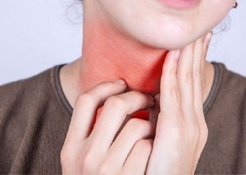 Causes of cervical lymphadenitis