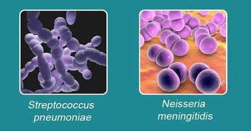 
Vi khuẩn Haemophilus influenzae nhóm B gây bệnh viêm màng não mủ ở trẻ em
