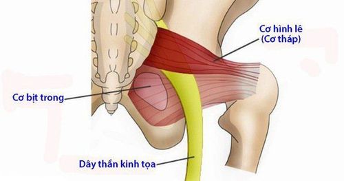 Đau lưng sau hai năm bị chấn thương cơ hình lê phải làm sao?