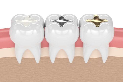 Choose the right filling material for your teeth