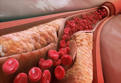 Drugs to treat high total cholesterol