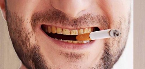 How do smoking and sleep affect oral health?