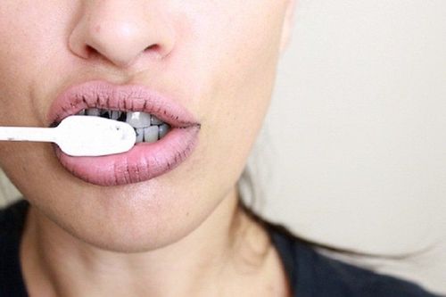 Should I whiten my teeth at home?