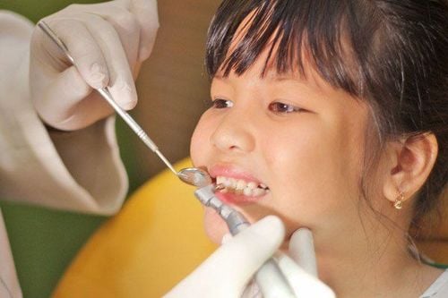 
Cha mẹ nên quan tâm đến vấn đề khám răng định kỳ cho trẻ
