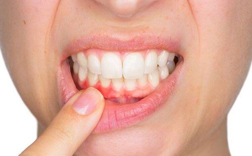 Gum disease can worsen blood pressure problems