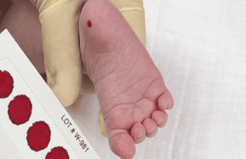 Xét nghiệm lấy máu gót chân cho trẻ 2 tháng tuổi có được không?