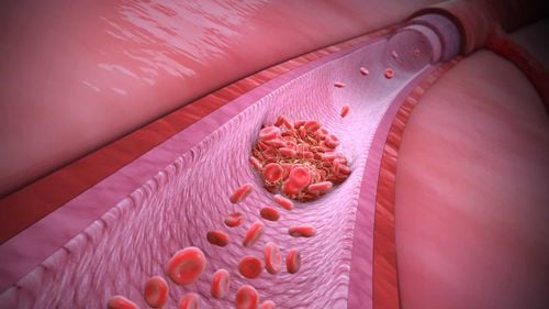 Diagnosis of blood clotting disorder