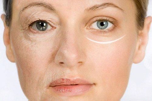 8 effective ways to reduce wrinkles