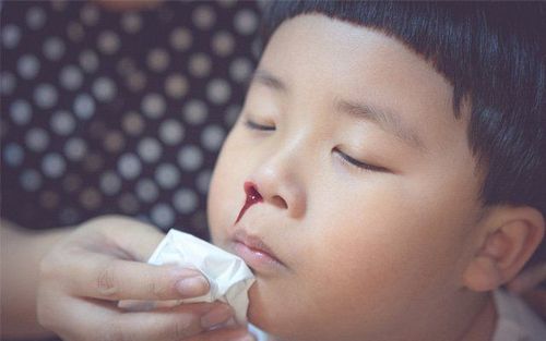 Trẻ chảy máu mũi nguyên nhân là gì?