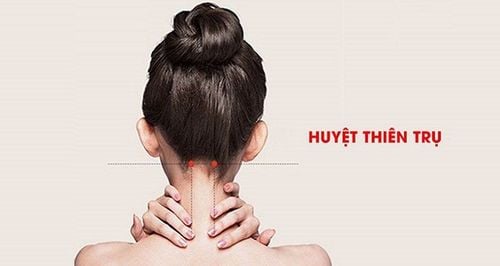 
Huyệt Thiên Trụ là một trong các huyệt vùng vai gáy
