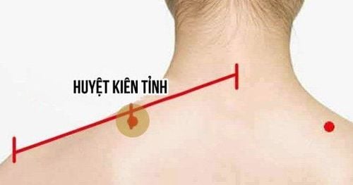 
Trong đông y huyệt kiên tỉnh có tác dụng làm dịu tinh thần
