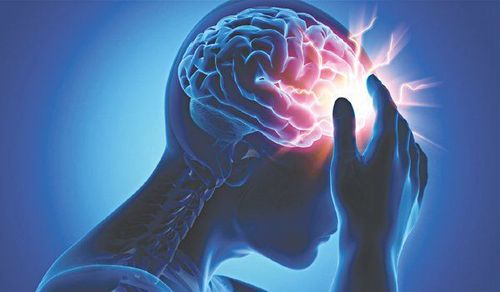 Bất sản động mạch não là gì?
