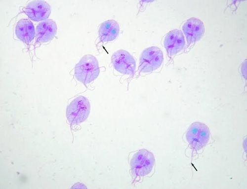 
Ký sinh trùng trong thực phẩm cần thận trọng với trùng roi Giardia
