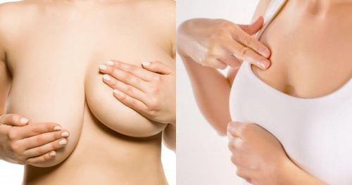 Is it okay for women with large breasts on the small side after giving birth?