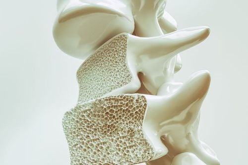 Prevention and treatment of corticosteroid-induced osteoporosis