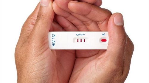 Bạn có thể nhiễm HIV khi quan hệ không dùng bao cao su tránh thai