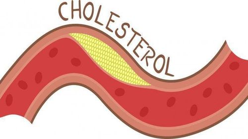 Cholesterol total 5.4 có nguy hiểm không?