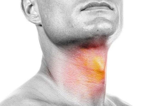 A visual guide to head and neck cancer