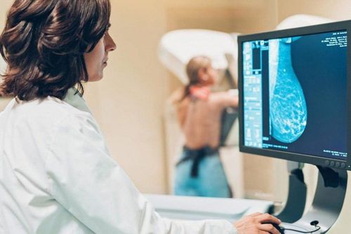 Chụp X quang vú có chẩn đoán được ung thư vú không?