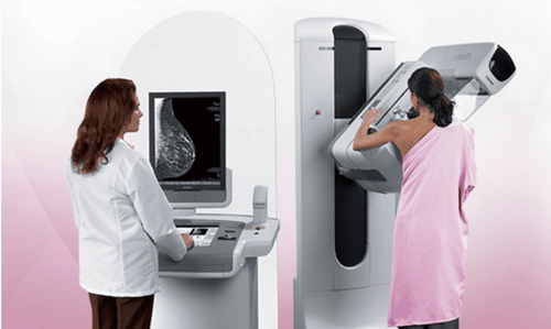 Kết quả chụp X quang vú bất thường nên làm gì?