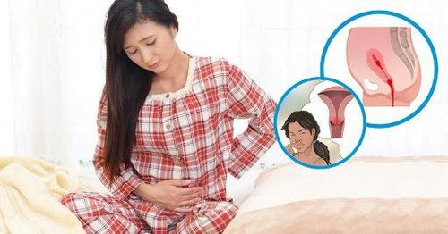 Sản dịch sau sinh màu nâu chuyển đỏ bầm có sao không?