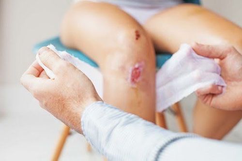 Khi cắt vết hoại tử chân cho trẻ có thể dùng phương pháp gây mê nào?